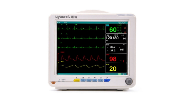 ECG Monitor